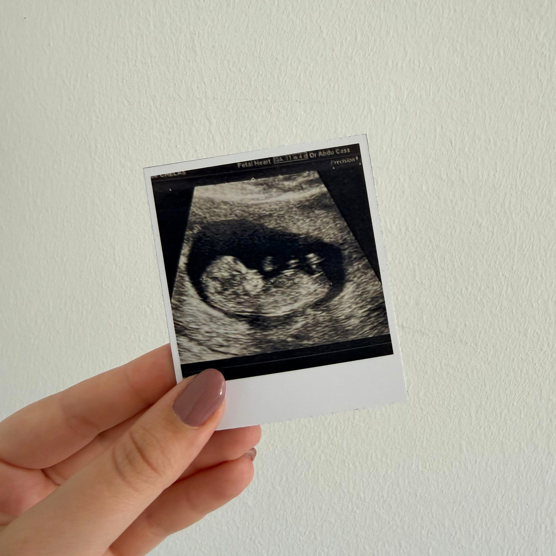 íman polaroid personalizado com ecografia, ideal para anunciar gravidez à família e amigos
